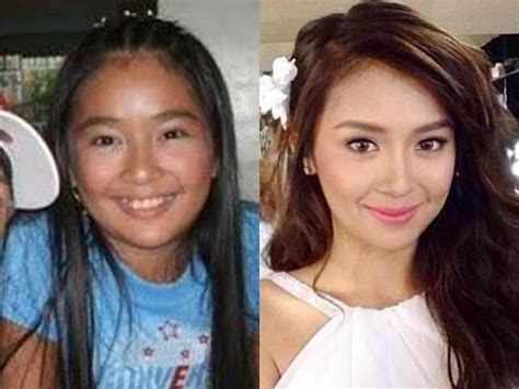 bernardo kathryn|kathryn bernardo before and after.